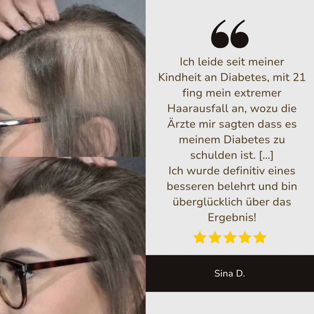 HaarMony Hair Grow Brush - Die Lösung gegen Haarausfall