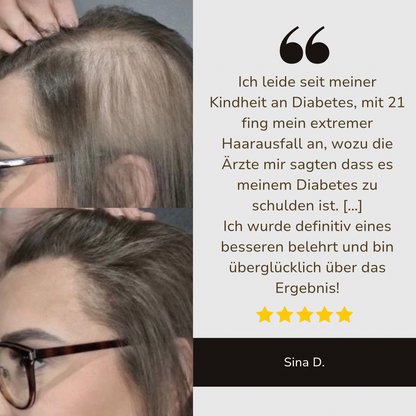 HaarMony Hair Grow Brush - Die Lösung gegen Haarausfall
