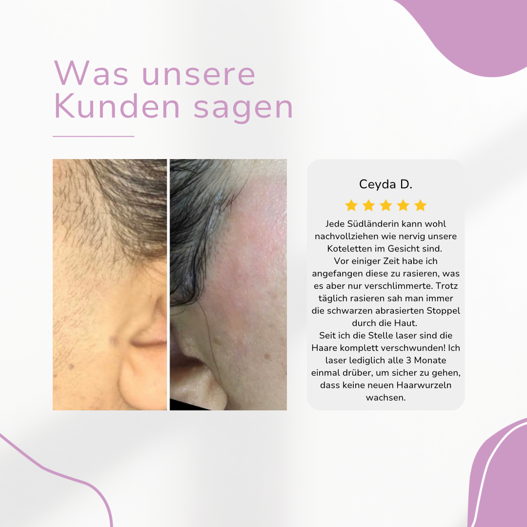 HaarMony IPL Hair Remover I Die führende Laser-Haar-Entfernung für Zuhause