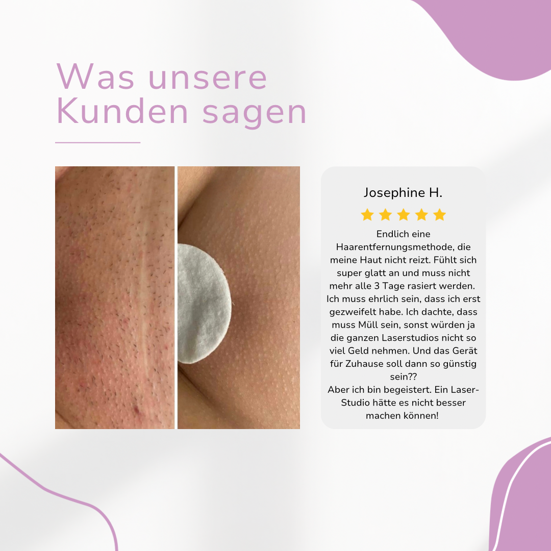 HaarMony IPL Hair Remover I Die führende Laser-Haar-Entfernung für Zuhause
