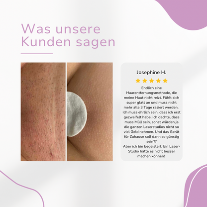 HaarMony IPL Hair Remover I Die führende Laser-Haar-Entfernung für Zuhause