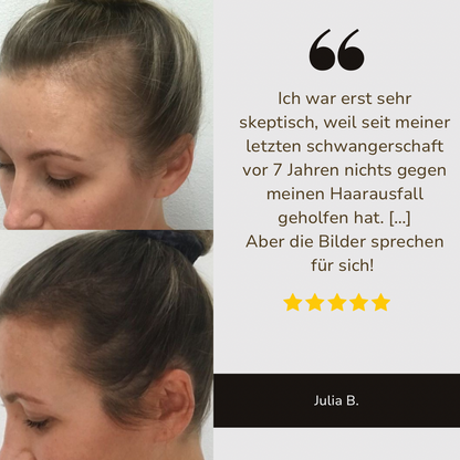 HaarMony Hair Grow Brush - Die Lösung gegen Haarausfall