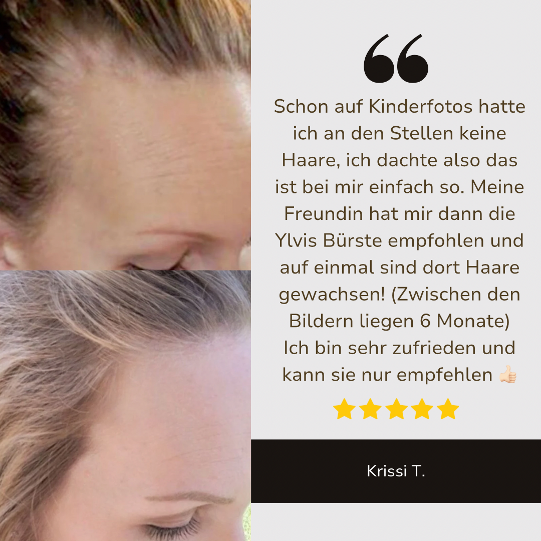 HaarMony Hair Grow Brush - Die Lösung gegen Haarausfall